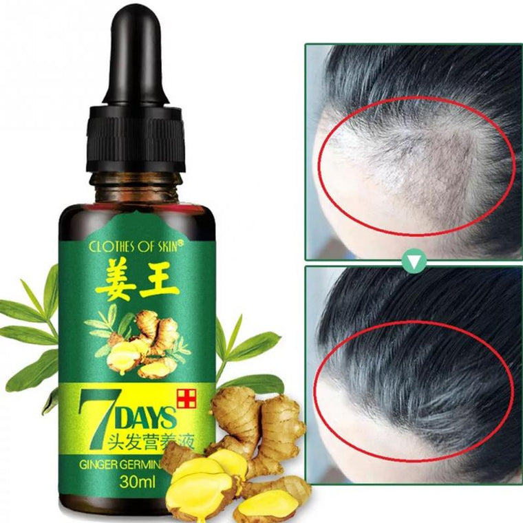 Unisex Anti Hair Loss Treatment Serum Ginger Extract Hair Regrowth Organic Beard Oil Growing Men Women Hair Care #508